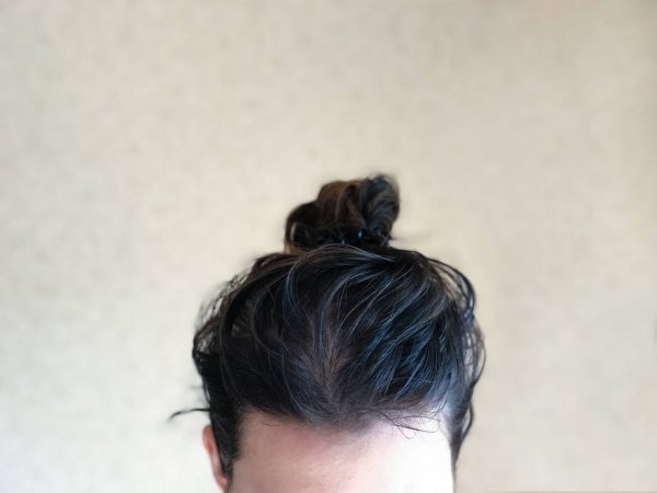 greasy hair